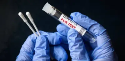 частным лабораториям разрешили принимать анализы по КВИ без разрешения