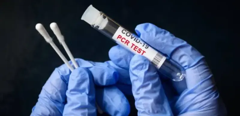 частным лабораториям разрешили принимать анализы по КВИ без разрешения