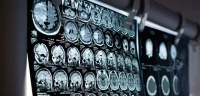 Суд оштрафовал родителей за драку их ребенка